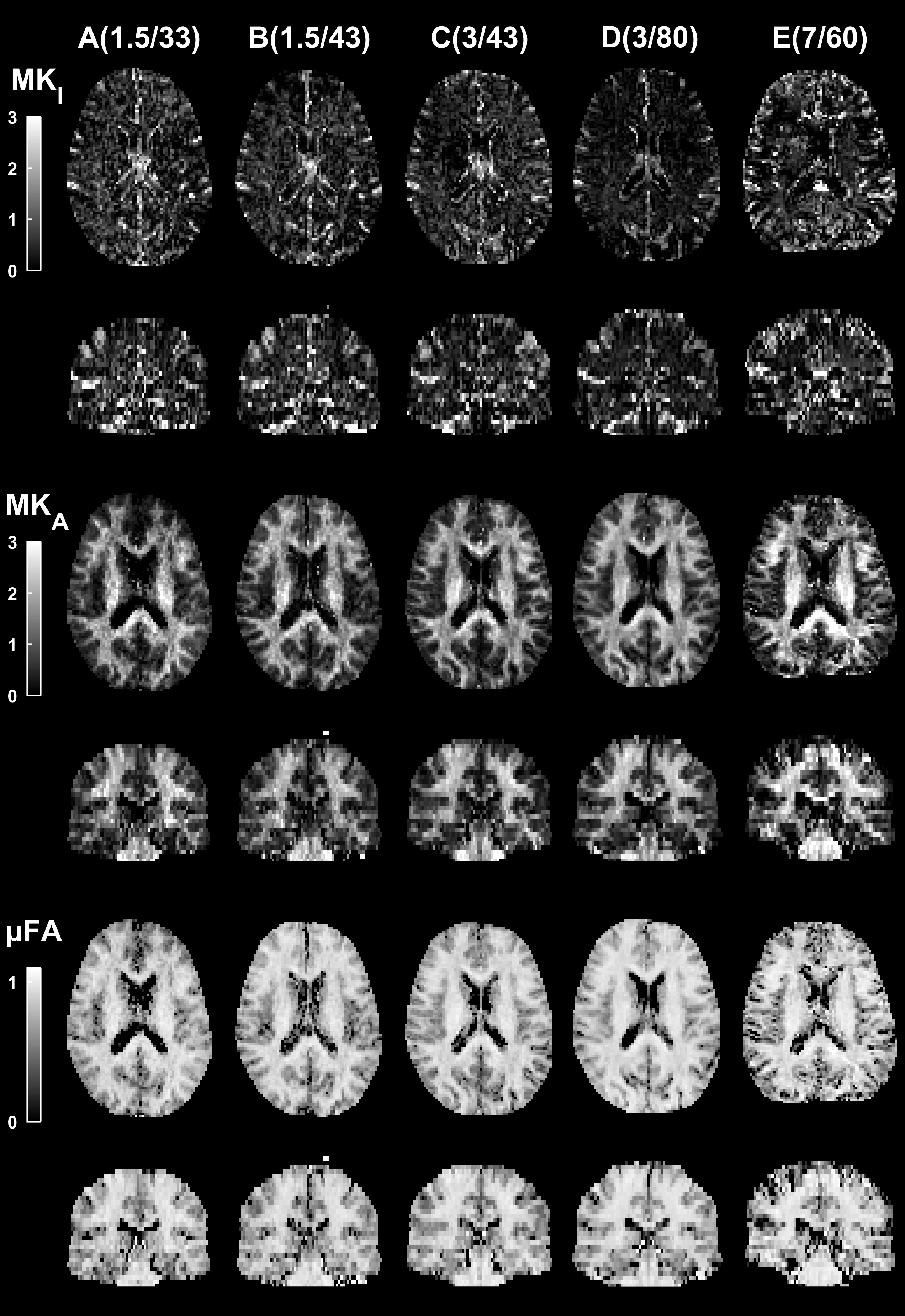 Parameters supported by tensor-valued diffusion encoding at multiple MRI systems