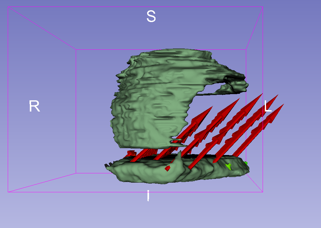 transformation field overlaid with target volume